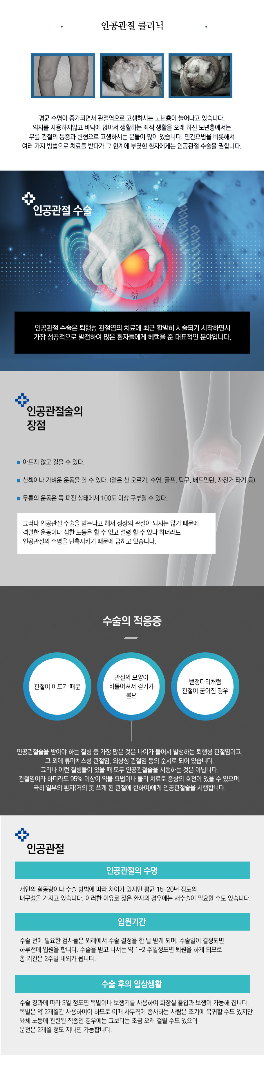 인공관절 클리닉
